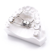 palatal expander model